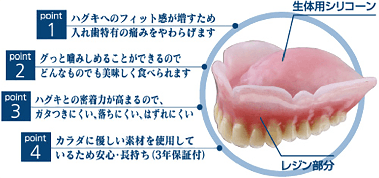 生体用シリコン義歯（コンフォート）の特徴
